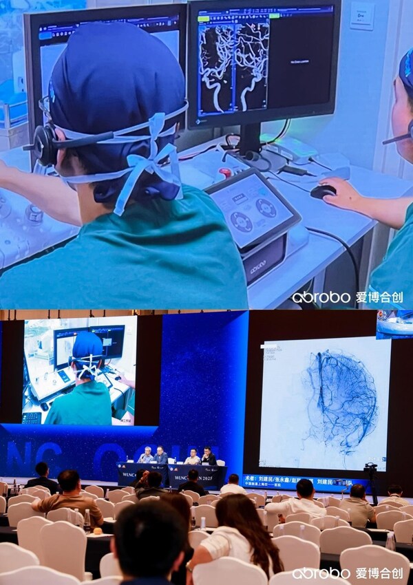 神經(jīng)介入手術(shù)現(xiàn)場(chǎng)直播演示