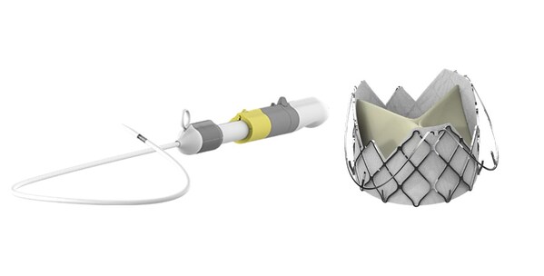 圖為“J-VALVE TF瓣膜”