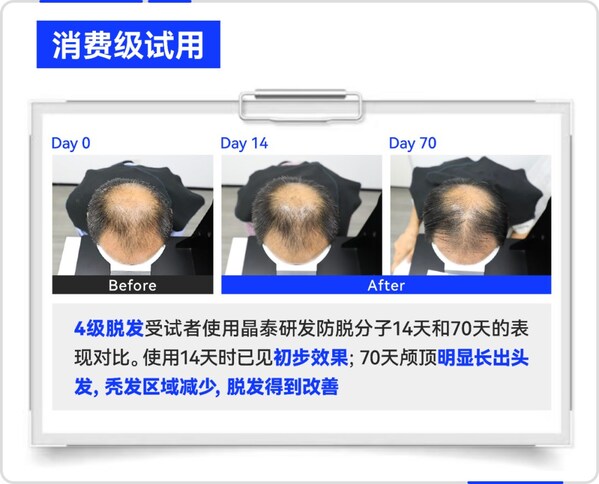 晶泰科技 AI 研發(fā)生發(fā)分子消費(fèi)級(jí)試用效果案例